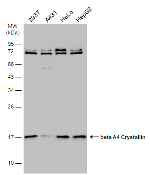 beta A4 Crystallin antibody [N1C3-2]