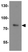OATP2 antibody