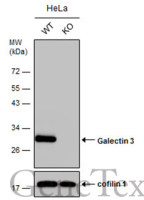 Galectin 3 antibody