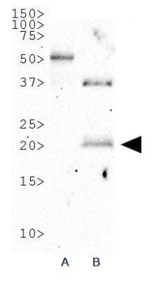 p19ARF antibody