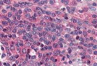 Prostaglandin E Receptor EP1 antibody, Internal