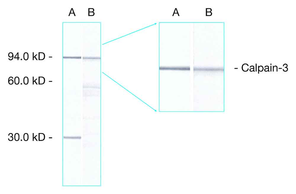 Calpain 3 antibody [Calp3d/2C4]