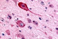 GABA B Receptor 1 antibody