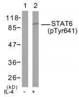 STAT6 (phospho Tyr641) antibody
