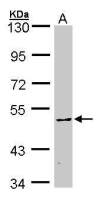 CaMKIV antibody