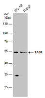 TAB1 antibody