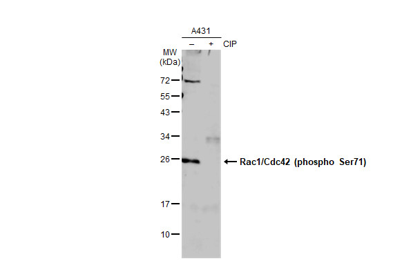 Rac1 + CDC42 (phospho Ser71) antibody [GT1345]
