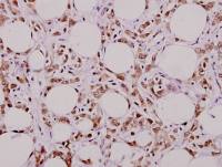 MUTYH antibody