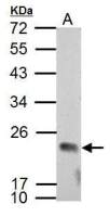 APOBEC3C antibody