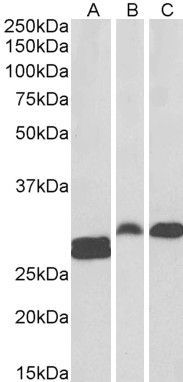 ANP32B antibody, C-term