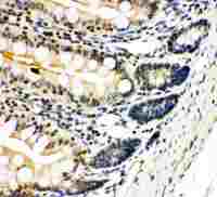 NFkB p100/p52 antibody