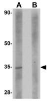 RWDD3 antibody
