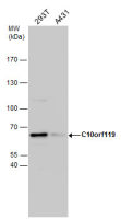 MCMBP antibody
