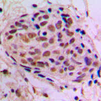 CREB antibody