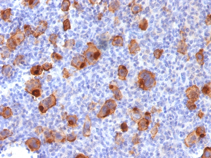CD30 antibody [Ki-1/1747R]