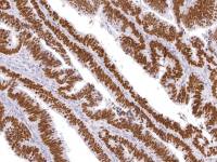 p53 antibody [IHC053]