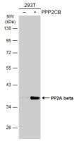 PP2A beta antibody