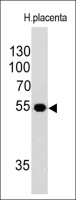ODC antibody [ODC1/485]