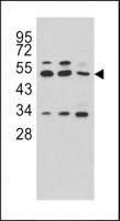 CPA4 antibody, C-term