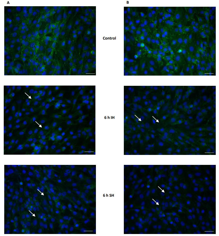 低氧/厌氧产品案例——阻塞性睡眠呼吸暂停（OSA）与血脑屏障研究