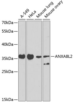 Annexin A8 like 2 antibody