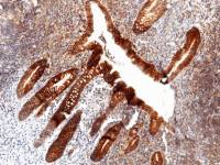 LI-Cadherin antibody [029]