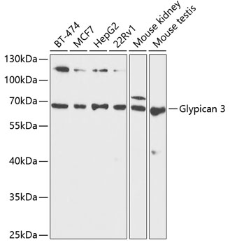 Glypican-3 antibody