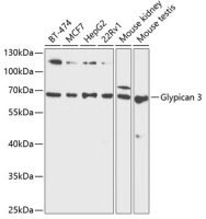 Glypican-3 antibody