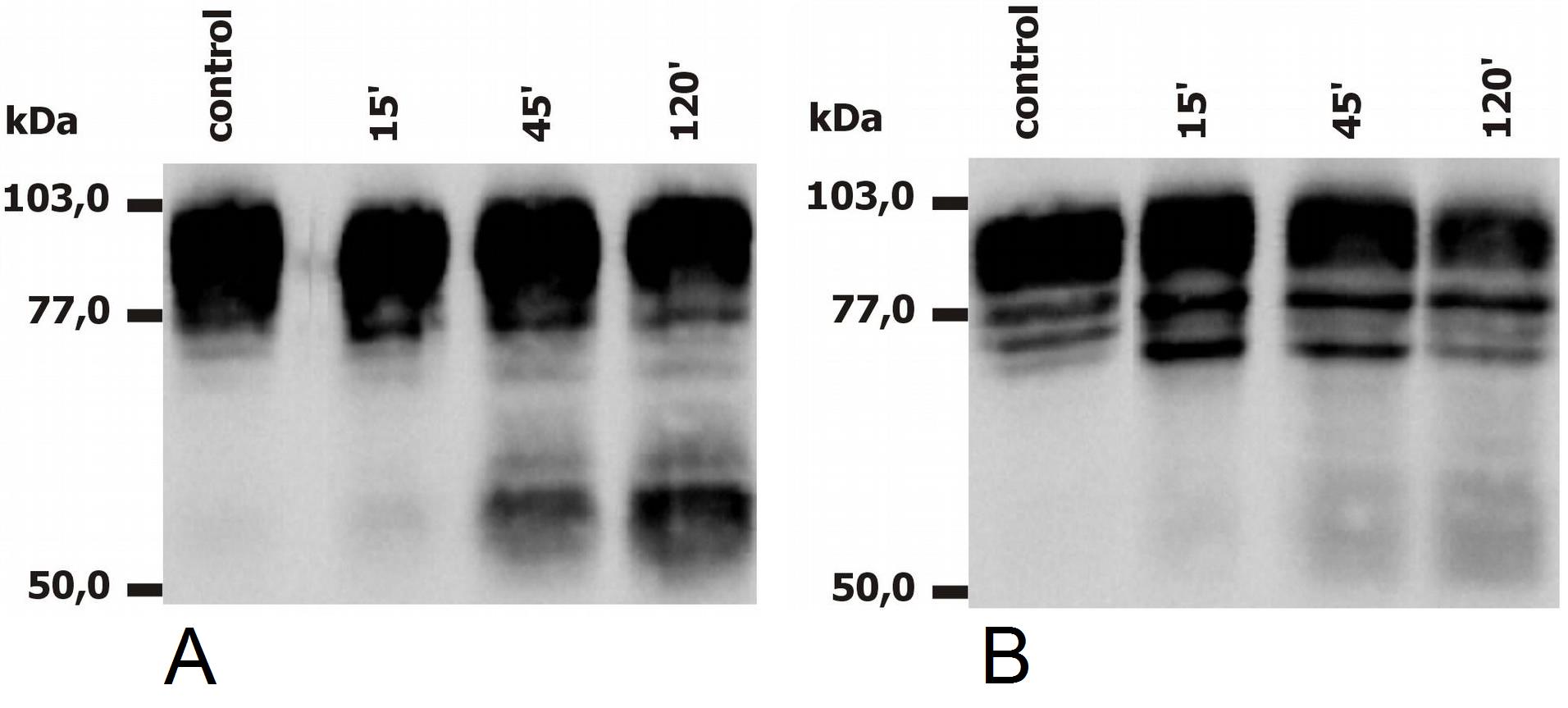 CD18 antibody [MEM-148]