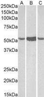 ALDH1A1 antibody, C-term