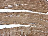 Calsequestrin 2 antibody