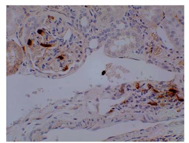 Neutrophils antibody [3G23]