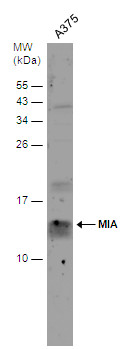 MIA antibody