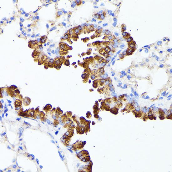 SMYD4 antibody