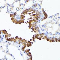 SMYD4 antibody