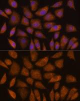GCLC antibody