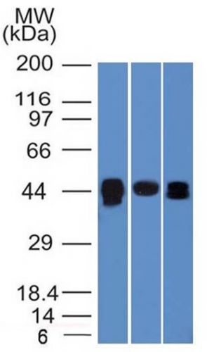 TIA1 antibody [TIA1/1313]