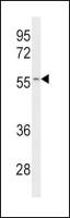 CYP2C19 antibody, Internal