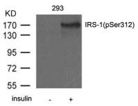 IRS1 (phospho Ser312) antibody
