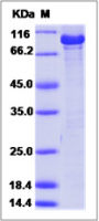 Human Chk2 protein, GST tag
