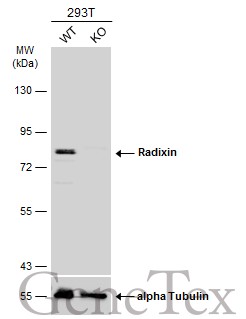 Radixin antibody