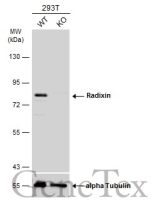 Radixin antibody