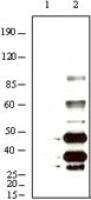 KSHV K8 alpha antibody [8C12G10G1]