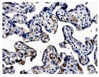 EPO receptor antibody [MM0031-6G7]