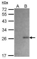 6X His tag antibody (HRP)
