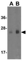 MettL7B antibody