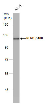 NFkB p100 antibody [C2C3], C-term