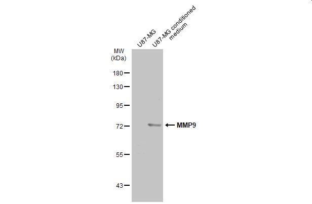 MMP9 antibody [N2C1], Internal产品图