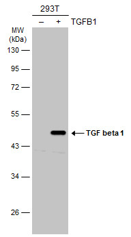 TGF beta 1 antibody