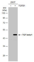 TGF beta 1 antibody